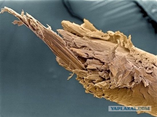Секущийся кончик волос - Фотографии из глубин человеческого тела