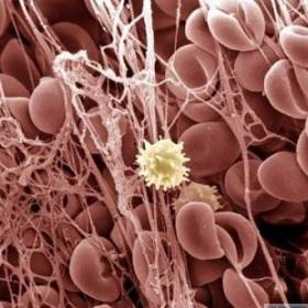 Сгусток крови - Фотографии из глубин человеческого тела