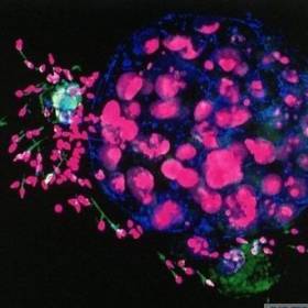 Человеческий эмбрион и сперматозоиды - Фотографии из глубин человеческого тела
