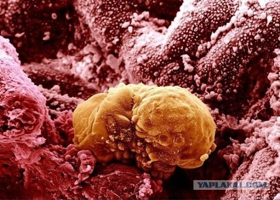 Эмбрион на шестой день развития - Фотографии из глубин человеческого тела