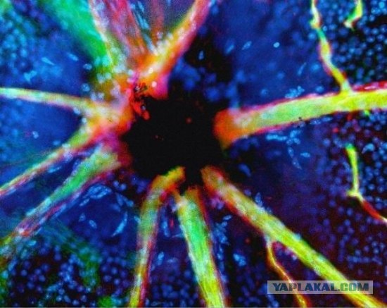 Кровяные сосуды зрительного нерва - Фотографии из глубин человеческого тела