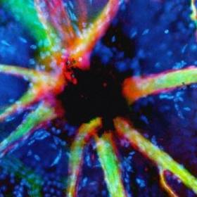 Кровяные сосуды зрительного нерва - Фотографии из глубин человеческого тела