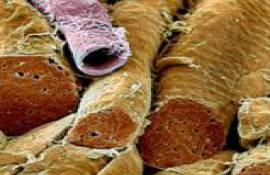 (СЭМ) разреза связки замороженных волокон гладких мышц (коричневые) с кровеносным сосудом (розовый, сверху слева). - Фотографии сделанные цветным сканирующим электронным микроскопом (СЭМ)