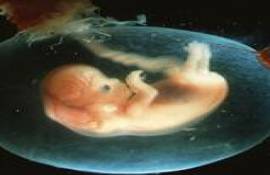 Вид 7-8 недельного человеческого эмбриона, известного также как эмбрион первого триместра, возраста менее 12 недель. Эмбрион прикреплен к плаценте, а также к кровообращению матери через пуповину (слева сверху), и как видно, плавает в амниотическом мешке, наполненном амниотической жидкостью. - Фотографии сделанные цветным сканирующим электронным микроскопом (СЭМ)