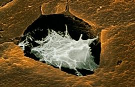 Микроснимок СЭМ поверхности излома костной клетки (остеоцит, белый) окруженной костью (коричневый). - Фотографии сделанные цветным сканирующим электронным микроскопом (СЭМ)