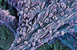 Цветной микроснимок СЭМ группы человеческих эмбриональных стволовых клеток (ЧЭСК, голубые и фиолетовые) на своих питающих клетках (зеленые).  Человеческие эмбриональные стволовые клетки являются плюрипотентными клетками, они способны дифференцироваться в любую из 200 типов клеток в организме человека - Фотографии сделанные цветным сканирующим электронным микроскопом (СЭМ)