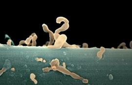 Цветной микроснимок СЭМ нанобактерии (нанобы, коричневые) на песчинке. Они, как полагается, самые маленькие самовоспроизводящиеся организмы, размером в 20 на 150 нанометров, меньше других бактерий. Они были обнаружены на 200 миллионов летнем песчанике, взятом из глубины в 3-5 километрах ниже (под) морского дна. Когда породы были раскрыты, нанобы начали размножаться и расти в лаборатории. Тесты показали, что они имеют ДНК (дезоксирибонуклеиновая кислота), молекулы содержащие программу жизни - Фотографии сделанные цветным сканирующим электронным микроскопом (СЭМ)