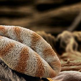 Благодаря извилистой поверхности пыльцы айвы (Chaenomeles), влага впитывается быстрее, когда пыльцевое зерно достигает цветка. «Чем быстрее увлажнение, тем быстрее формируется пыльцевая трубка, - объясняет швейцарский фотограф Мартин Оггерли, научный сотрудник госпиталя Университета Базеля. – Это очень важно для оплодотворения». - Потрясающая макросъемка photo © Martin Oeggerli