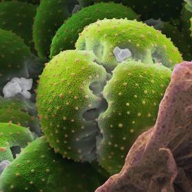 Пыльца мухоловки (Dionaea muscipula) более чем в 15 раз крупнее пыльцы незабудки: таким образом, прямой зависимости между размером цветка и пыльцевых зерен нет. - Потрясающая макросъемка photo © Martin Oeggerli