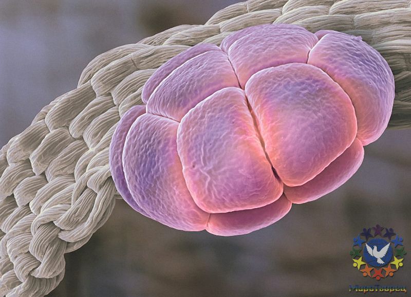 Пыльца шелковой акации (Albizia julibrissin) тоже более чем в 15 раз крупнее пыльцы незабудки. - Потрясающая макросъемка photo © Martin Oeggerli